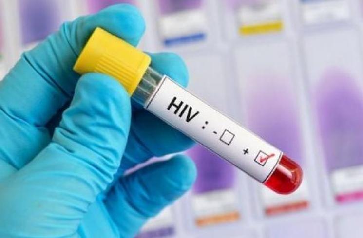 Ilustrasi HIV - (Shutterstock)