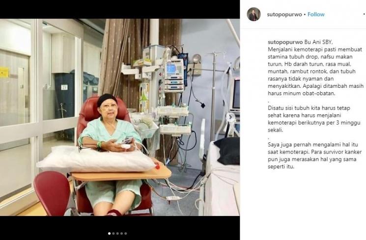 Sutopo Purwo Nugroho sarankan Ani Yudhoyono makan ikan gabus (Instagram/@sutopopurwo)