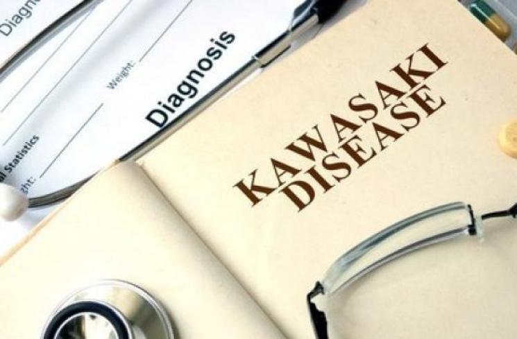 Ilustrasi penyakit Kawasaki. (Shutterstock)