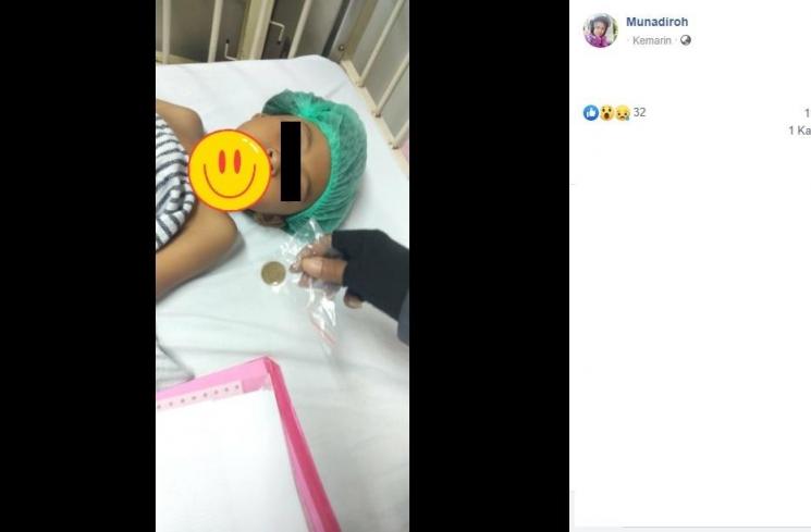 Anak menelan uang koin (Facebook/Munadiroh)
